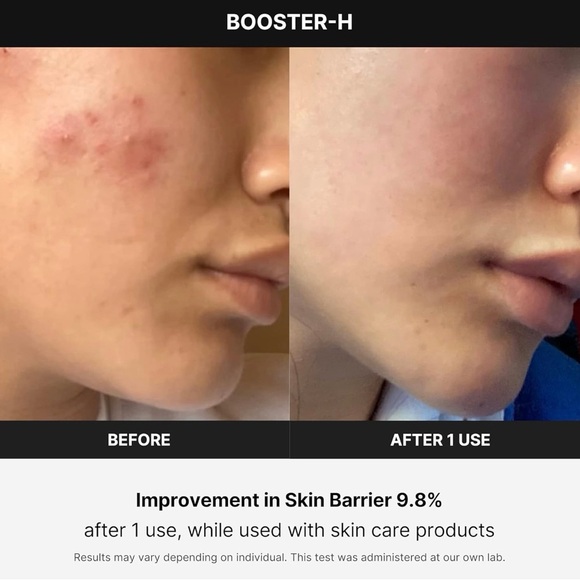 medicube Booster H - Korean Skincare Tool - Facial Glow Booster - Picture 5 of 8